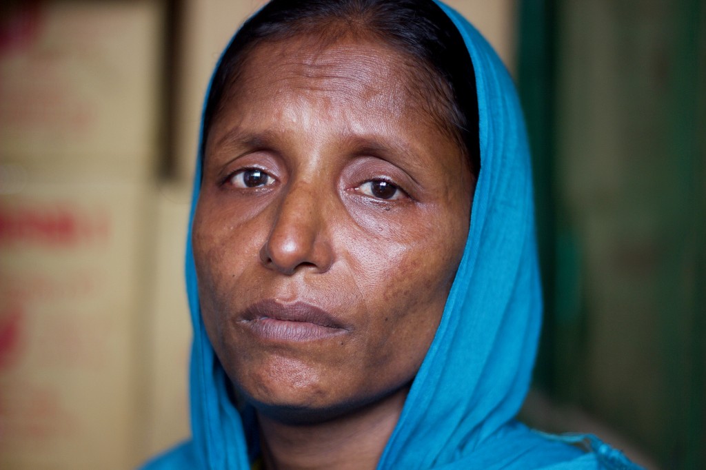 Rohingya Anwara close up